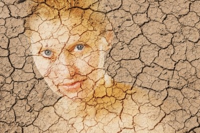 A recent study found that the effects of climate change could trigger eczema or worsen flare-ups of the skin condition (Image: Getty)